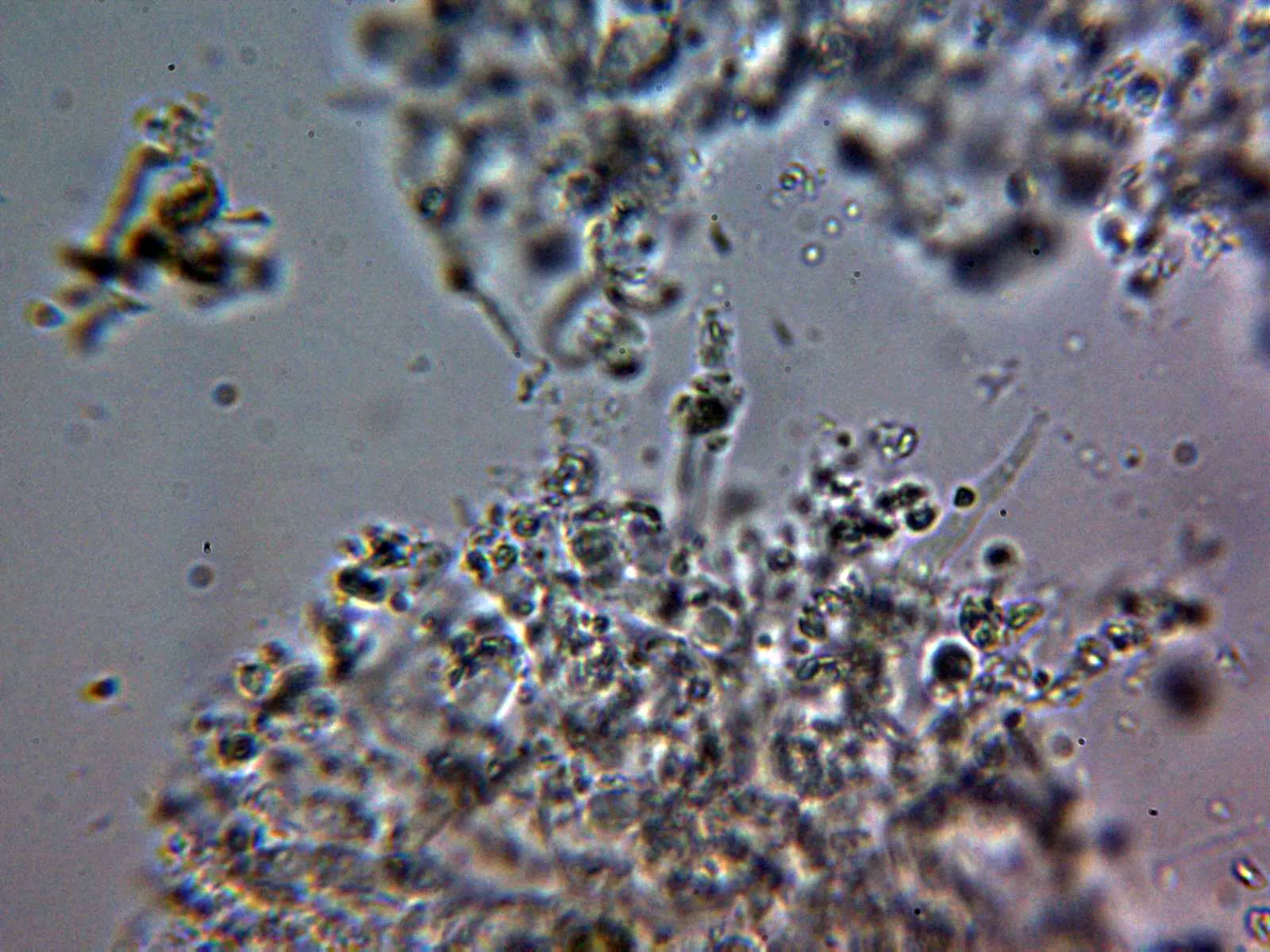 Microscopía de Lyomyces juniperi - 10 - Cistidio KOH